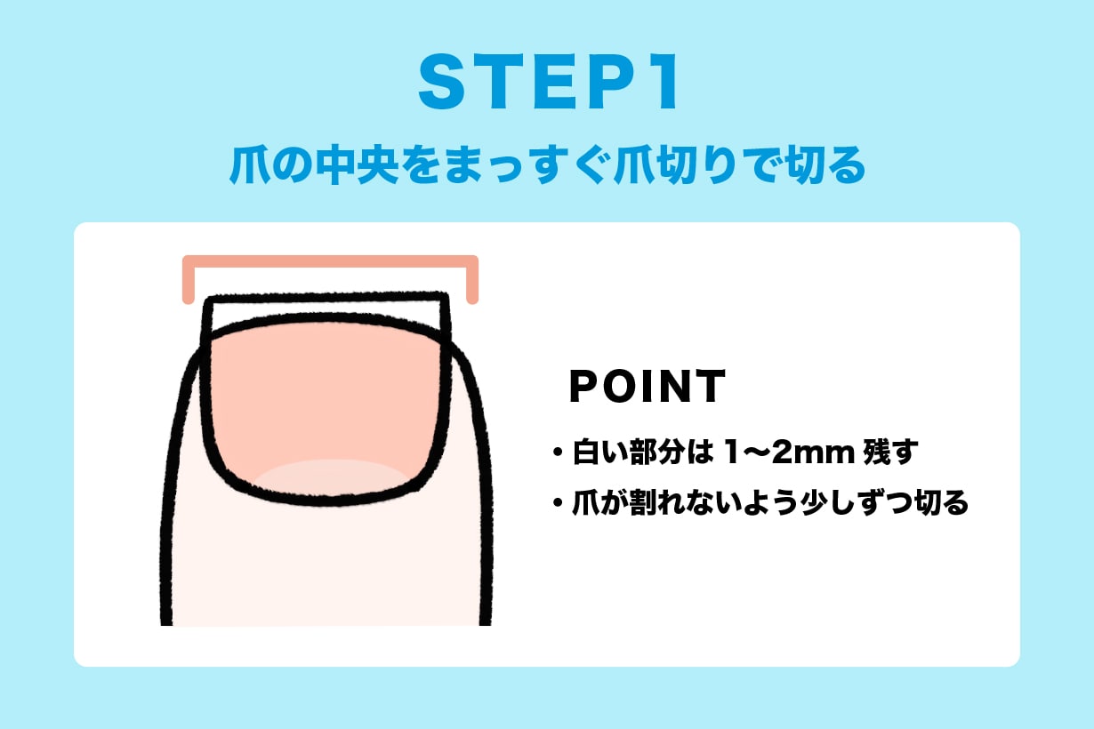 足の爪の正しい切り方って知ってる? 正しい手順や巻き爪の原因も解説 | となりのカインズさん